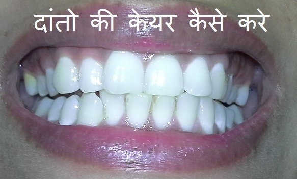 Teeth care tips in hindi